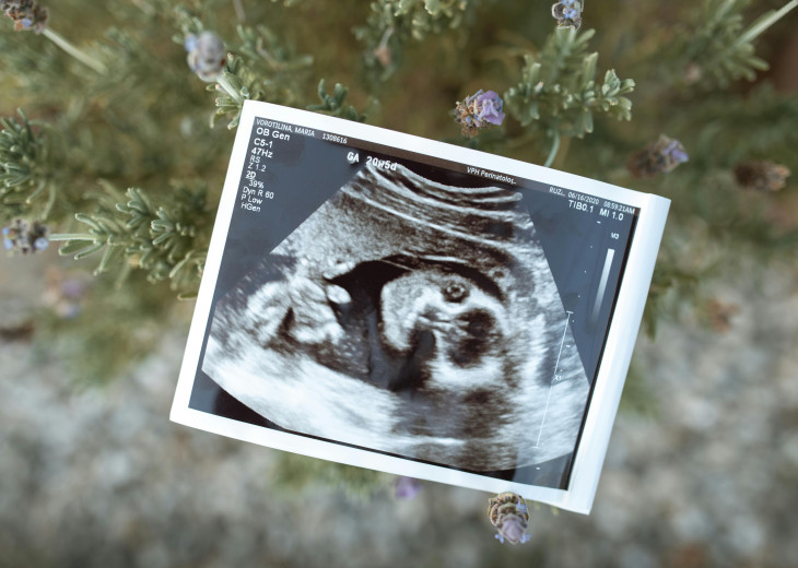 Pregnancy Ultrasound Image